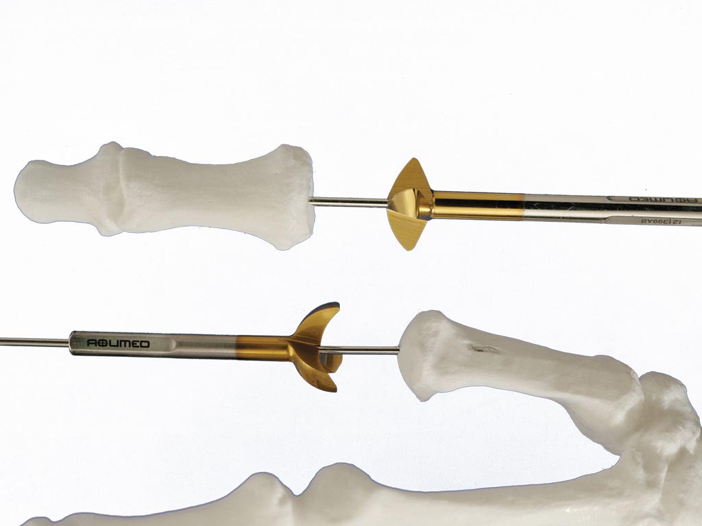 Small Joint Reamer System Acumed