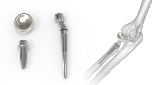 Anatomic Radial Head Solutions