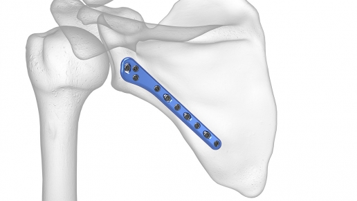 Lateral Border Plate