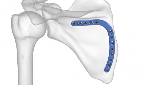 Medial Border Plate