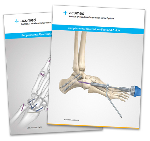 Standard Volar Distal Radius Plates