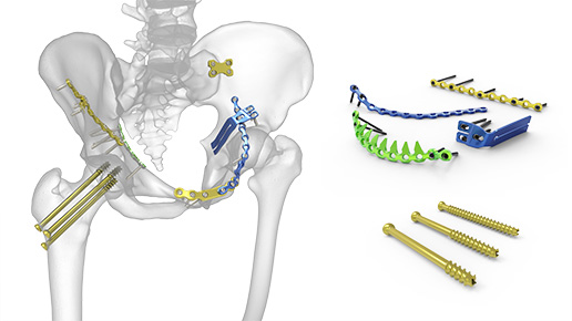 Acumed Hip & Pelvis Solutions