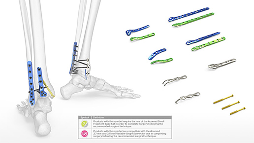 Ankle Plating System 3