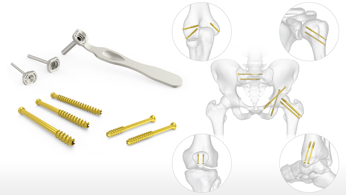 Headless compression screw insertion