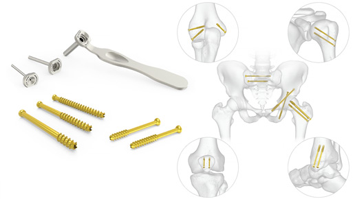 Cannulated Screw System