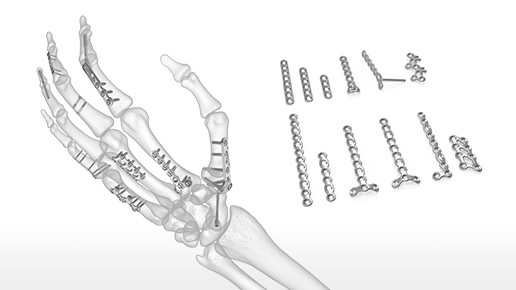 Hand Plating System