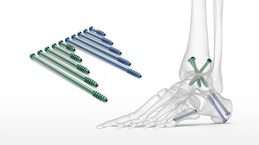 Large Cannulated Screw System