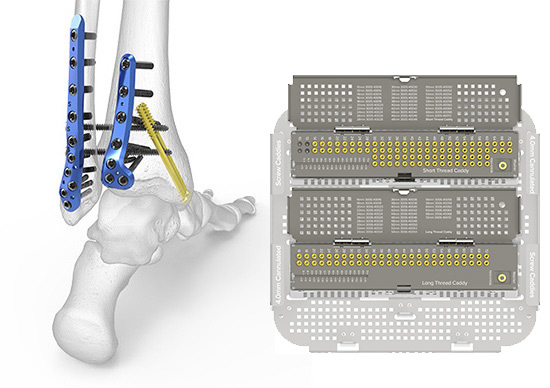 6.5 mm and 7.3 mm Cannulated Screws