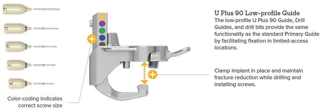 RibLoc U Plus Chest Wall Plating System | Acumed