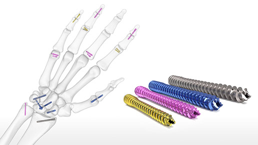 Acutrak 2 Headless Compression Screw System