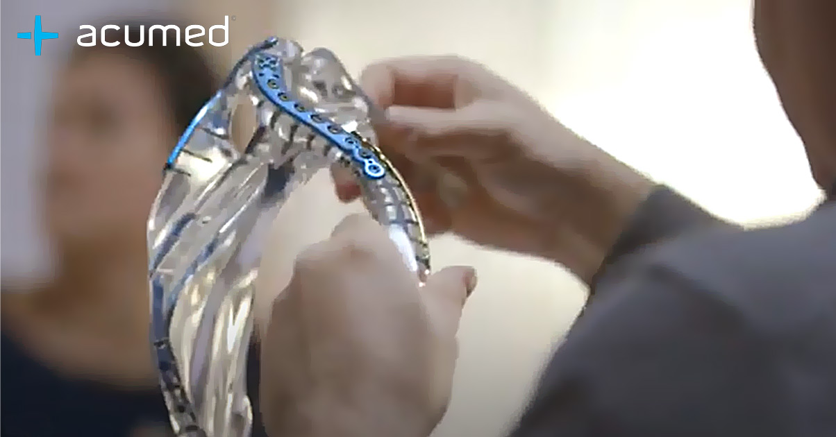 Acumed Surgical Orthopaedic Fracture Fixation Solutions